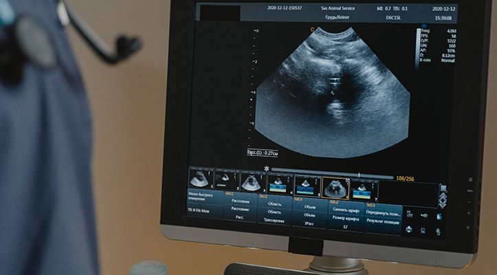 ultrasound image on computer